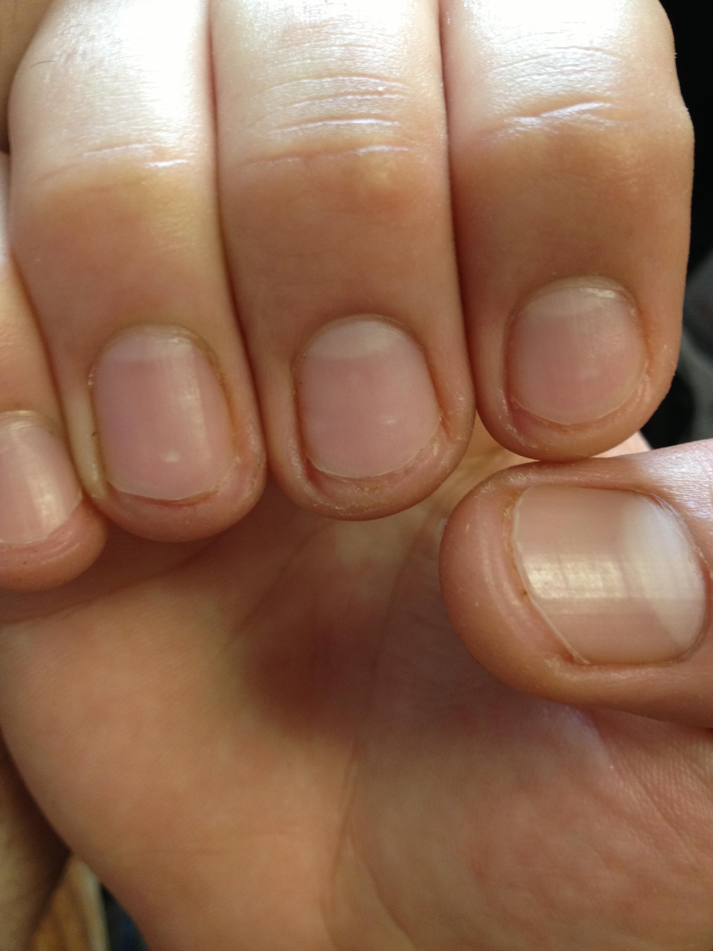 8-fingernails-cut-way-too-short-and-2-cut-just-right-the-georgetown